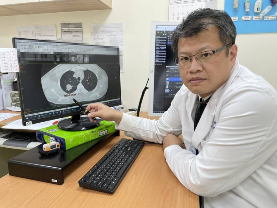 大同醫院篩出不菸也罹肺癌　副院長洪仁宇：早篩助治療