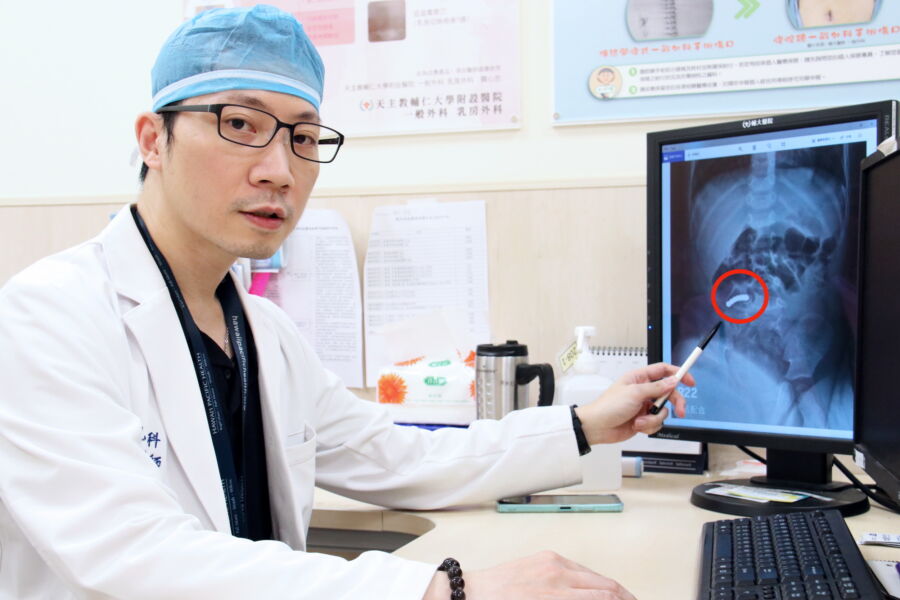 圖／輔大醫院小兒外科暨外傷科主任蔡煥文說，透過X光檢查，發現男童體內有7顆疑似具有強力磁性的巴克球。（圖／輔大醫院提供）