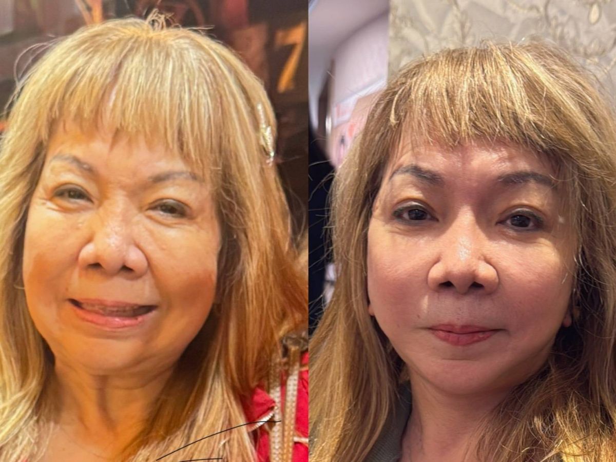 圖／萁媽外觀管理後，狀態很好。（陽光璨亮生醫提供）