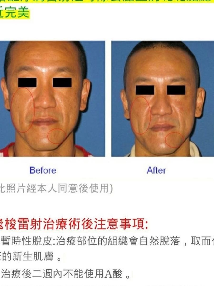 圖/這張照片近日在網路上瘋傳,醫美模特兒被發現是陳為民。(翻攝Threads)