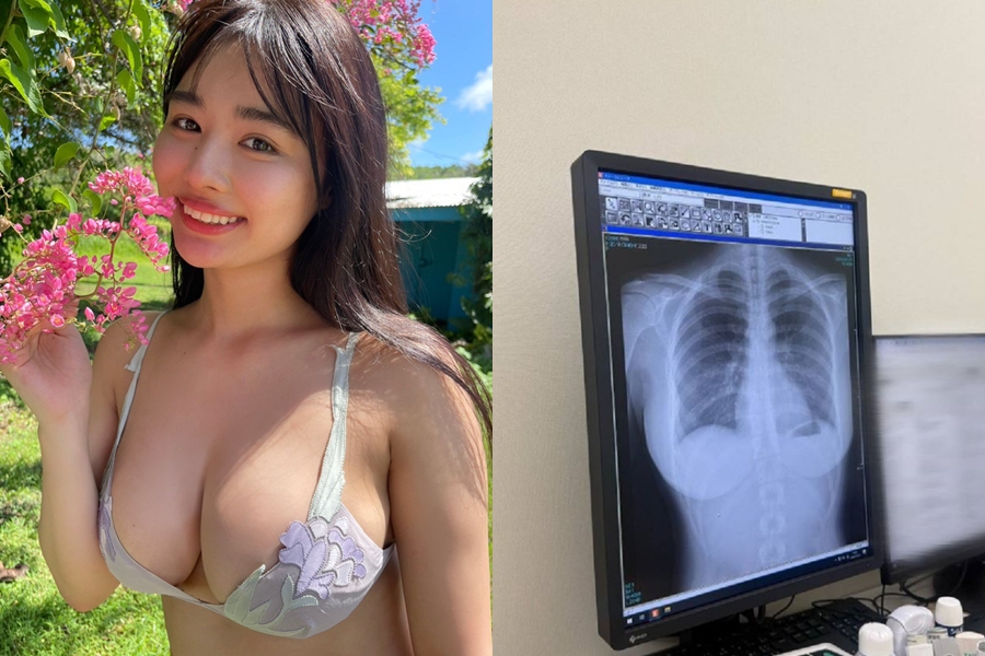 圖／豐島心櫻分享X光的照片，畫面瞬間讓網友大歪樓。（翻攝X）