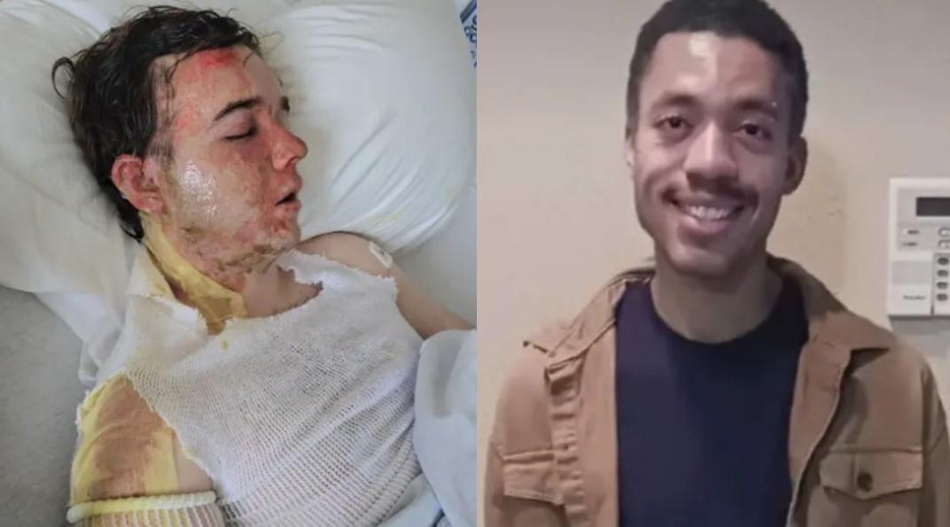 圖/麥當勞店經理Jacob Smith(左)無預警遭到同事Jalani Bluett(右)潑灑滾燙熱油。(翻攝 New York Post)
